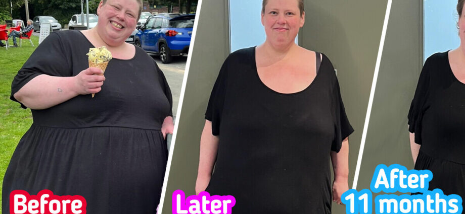 12 People Imprint Amazing Outcomes of Their Weight Loss Skedaddle