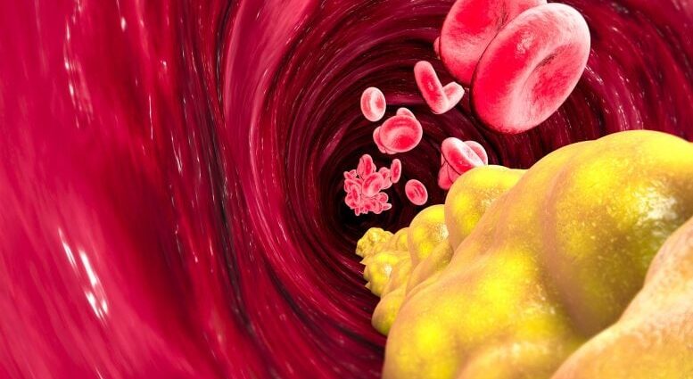 NIH Scientists Unmask the Hidden Secrets of “Despicable” Ldl cholesterol