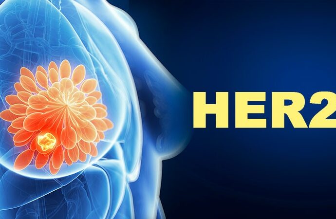 Which Tx Combo Is Handiest for HER2+ Breast Cancer?