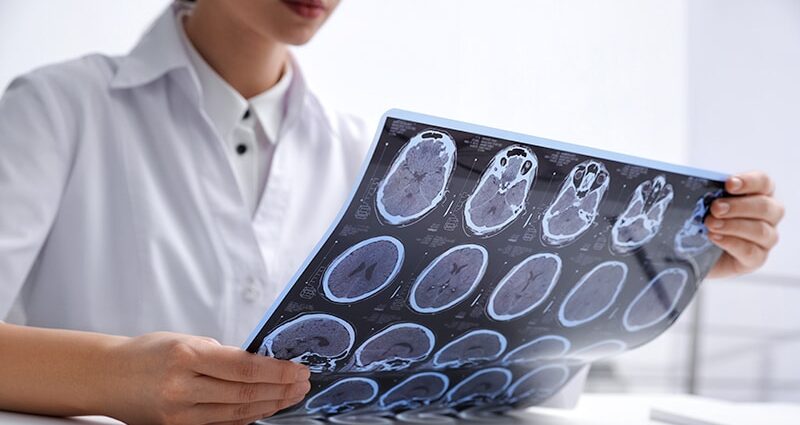 Experimental MS Drug Almost Eliminates Disease Activity