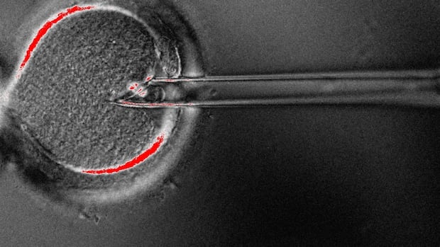 8 babies born with experimental 3-guardian IVF methodology